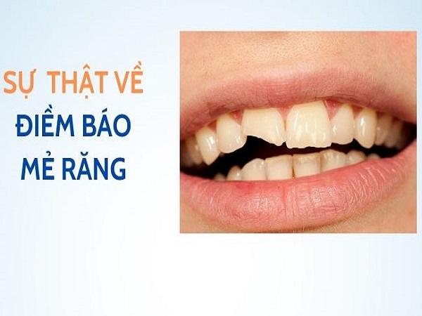 Góc nhìn tâm linh: Mẻ răng là điềm báo gì?